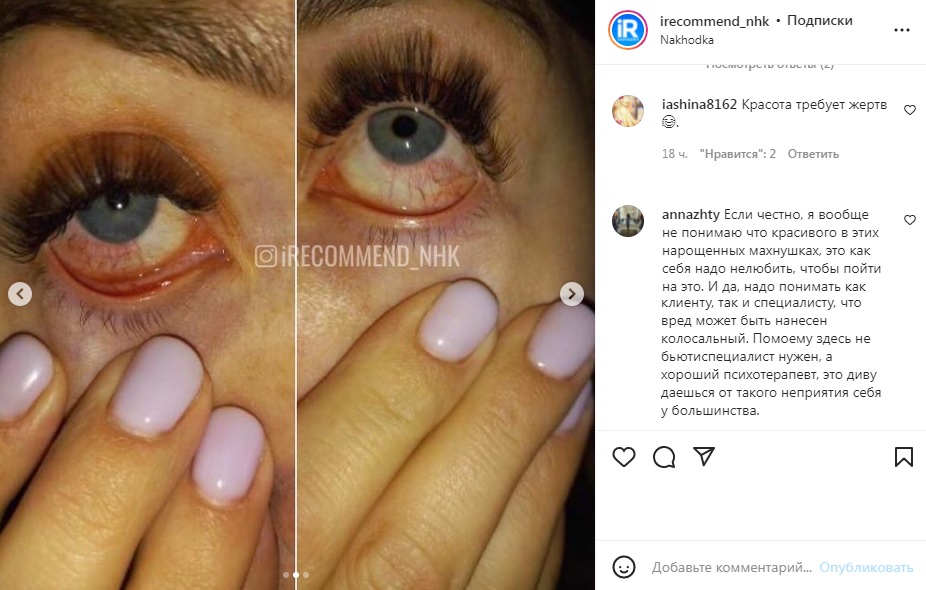 Жительница Приморья обомлела, когда увидела, что случилось с ее глазами после посещения студии наращивания ресниц