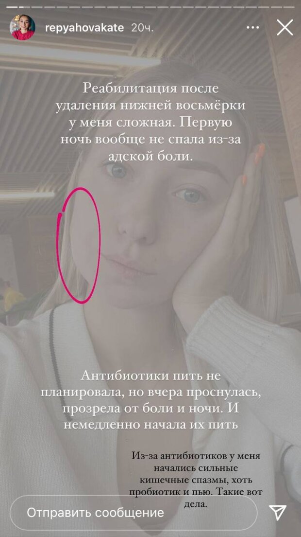 Катя Репяхова пожаловалась на проблемы со здоровьем: 